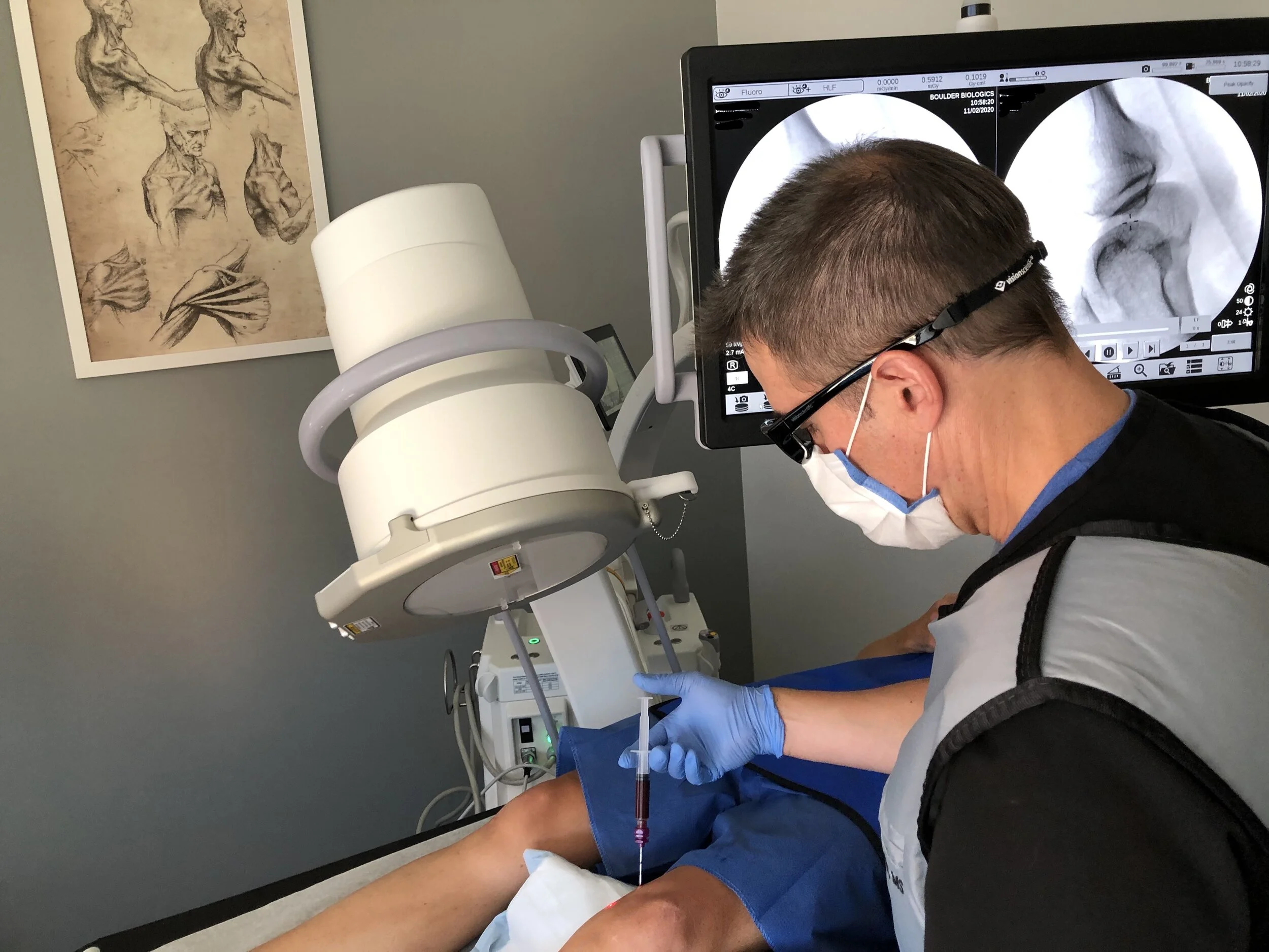 A physician performs a fluoroscopy-guided orthobiologic injection at Boulder Biologics